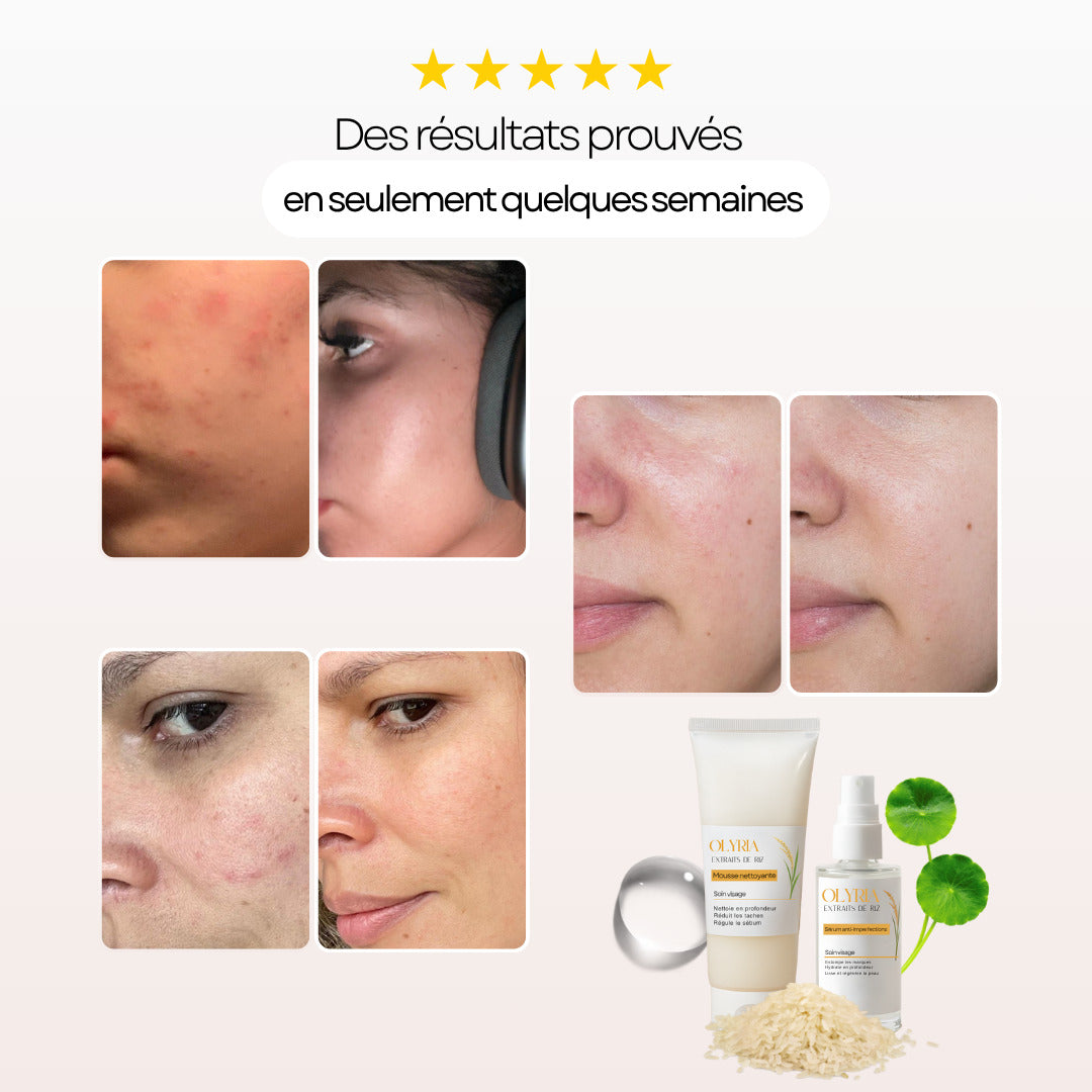 Sérum Anti-Imperfections au Riz