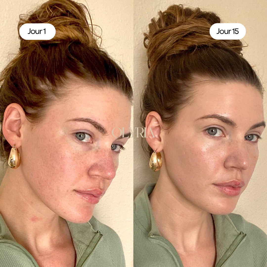 Routine Anti-Imperfections