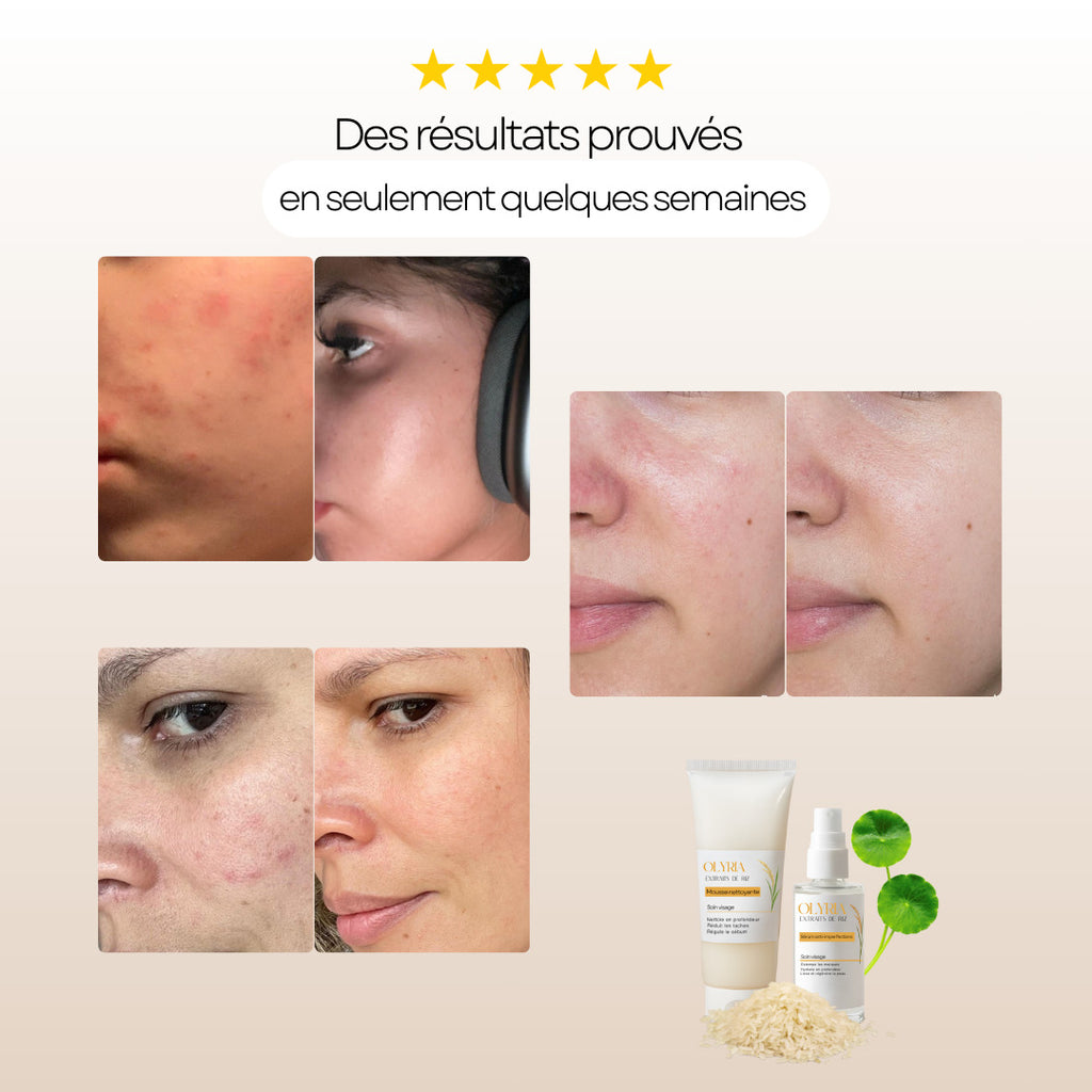 Sérum Anti-Imperfections au Riz