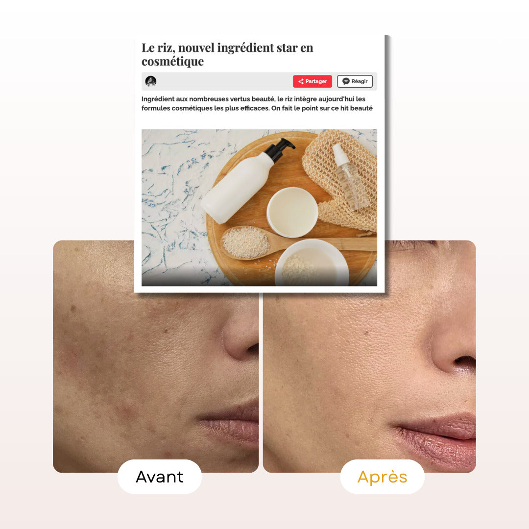 Sérum Anti-Imperfections au Riz
